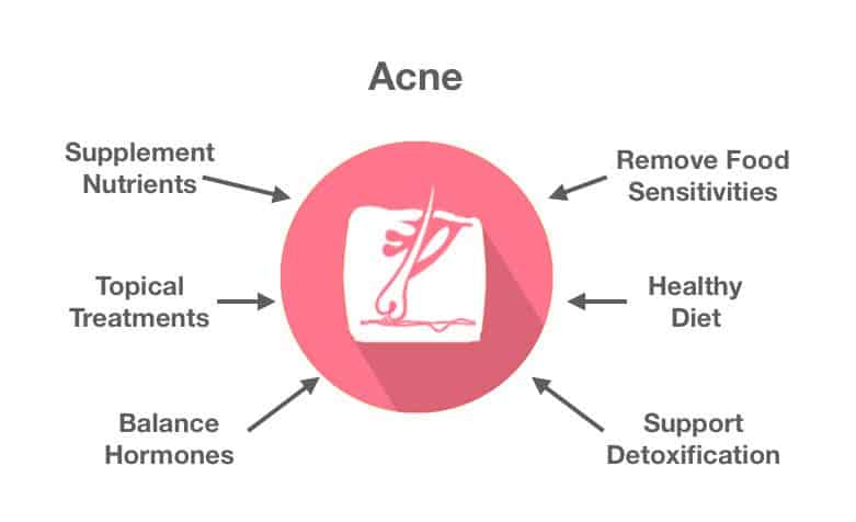 Guelph Naturopathic Medical Clinic - Treating Acne in Guelph